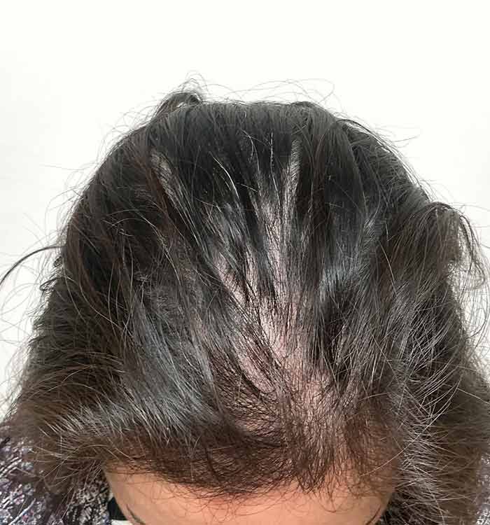 Female, 37, after