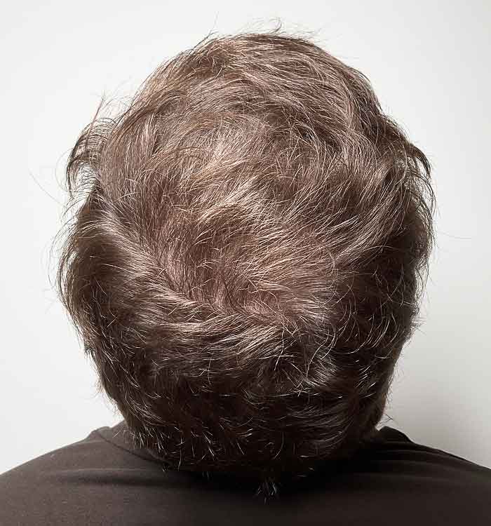 Male, 32, after