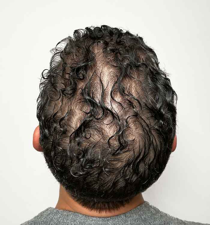 Male, 40, before