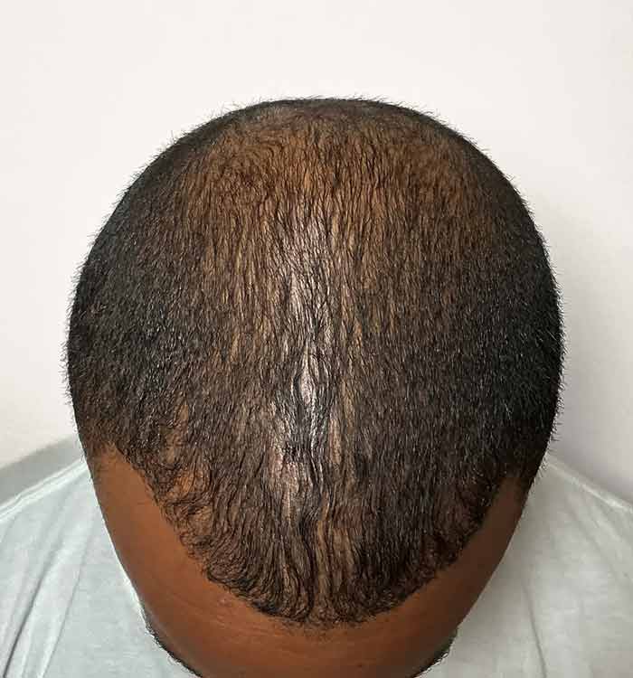 Male, 38, after