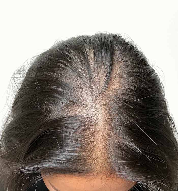 Female, 37, before