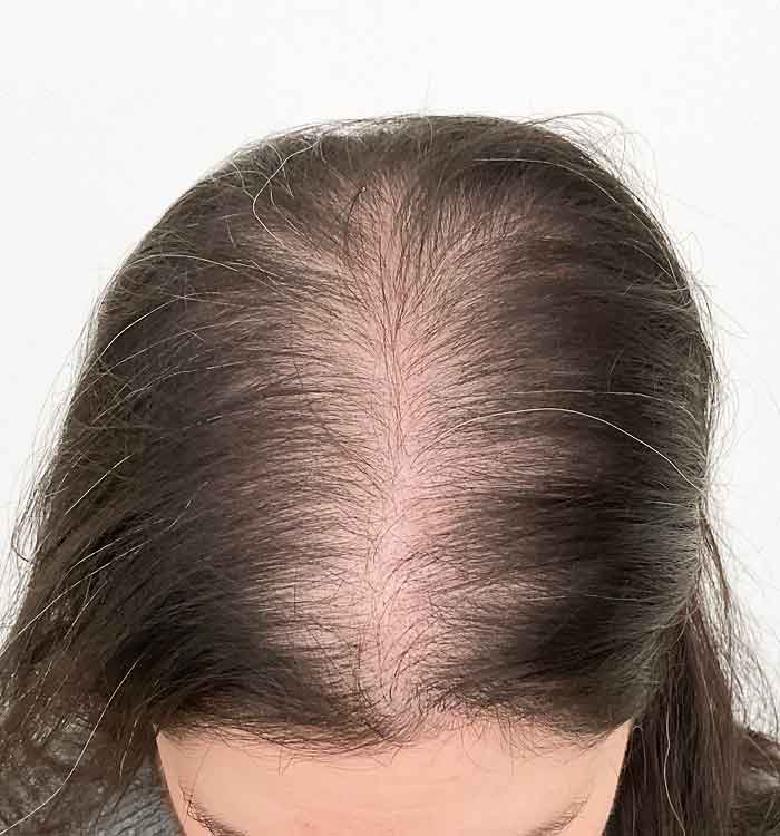 Female, 49, before