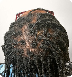 Female, 56, after