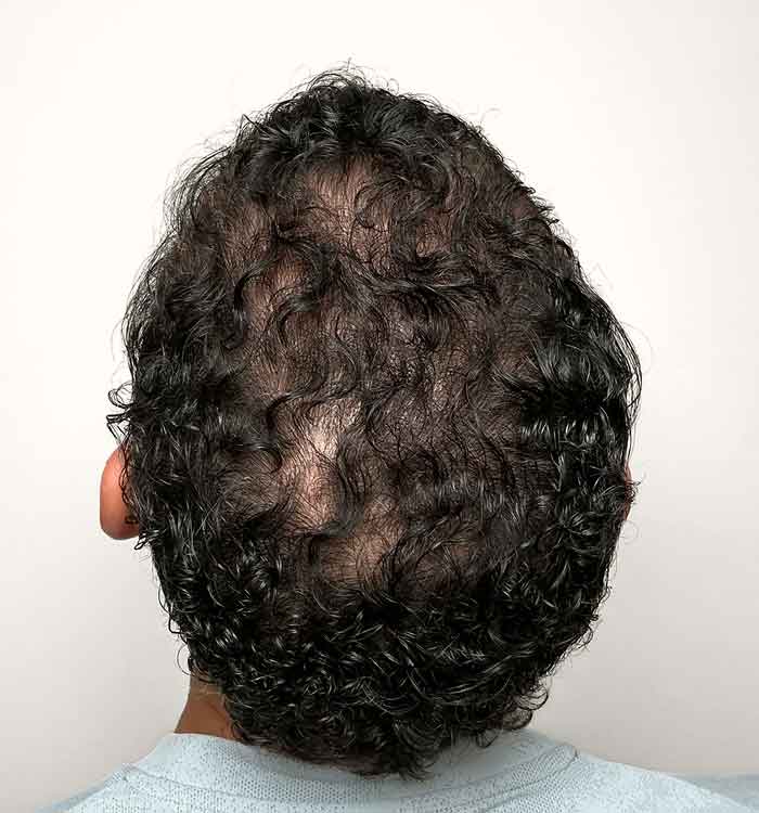 Male, 40, after
