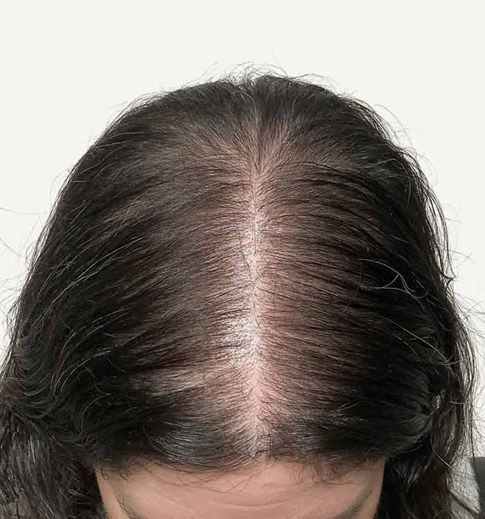 Female, 49, after