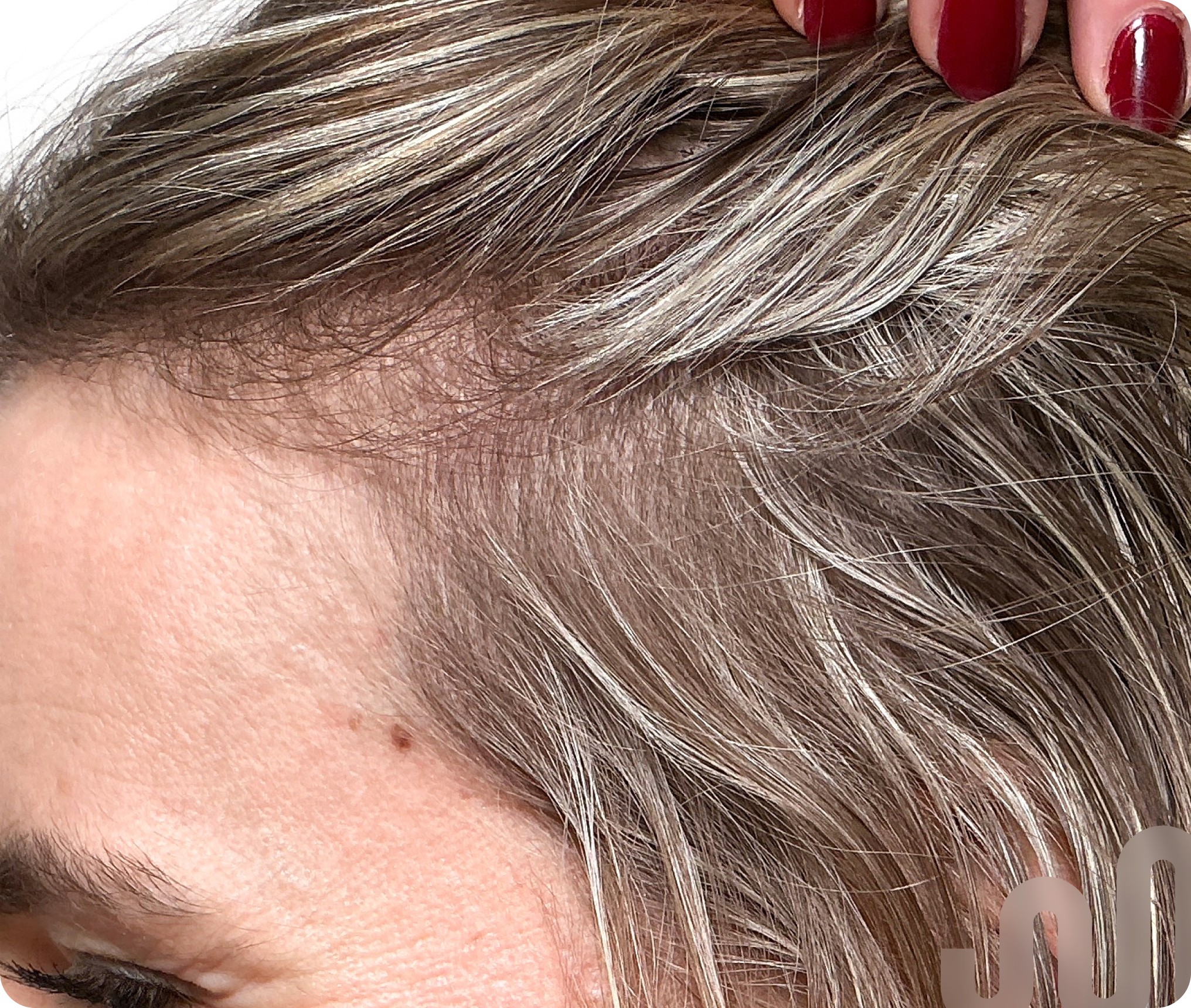 Female, 33, after