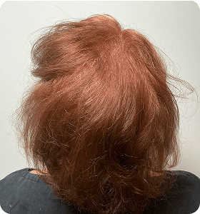 Female, 52, after