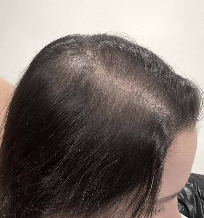 Female, 32, after